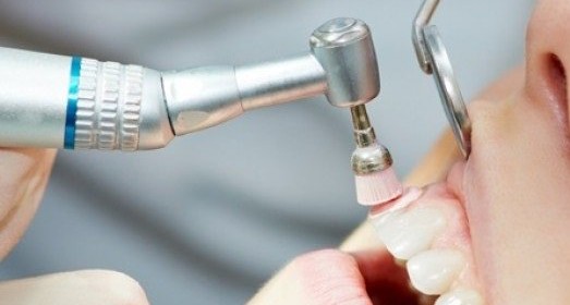 Truths About Dental Scaling