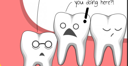 What is Impacted Tooth?