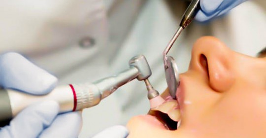 Why Teeth Scaling and Polishing important?