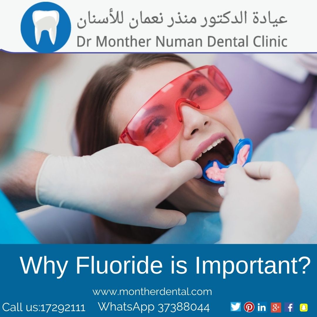 Why Fluoride is Important? Doctor Monther Numan Dental Clinic