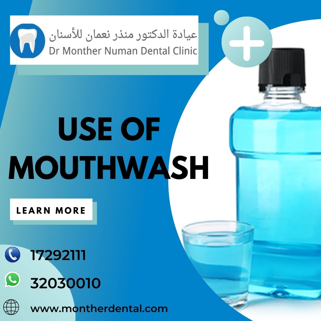 Use of Mouthwash Doctor Monther Numan Dental Clinic