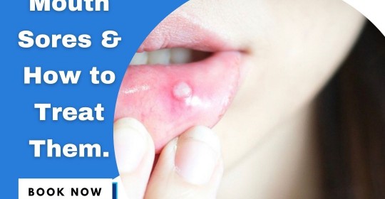 Mouth Sores, How to Treat Them?